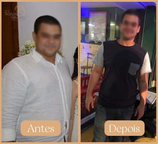 Antes-1-1