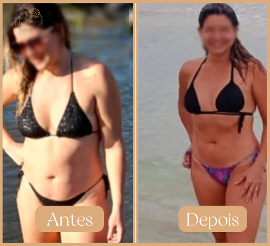 Antes-10-1