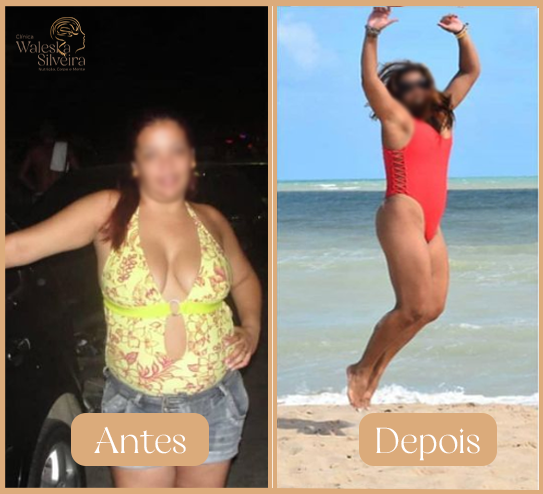 Antes-2-1