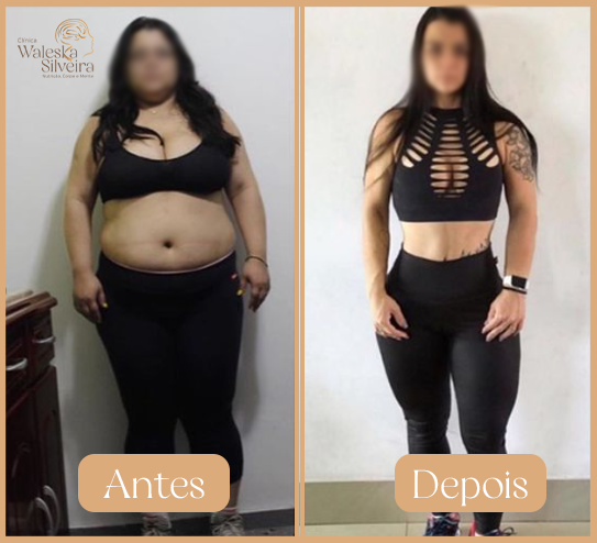 Antes-3-1
