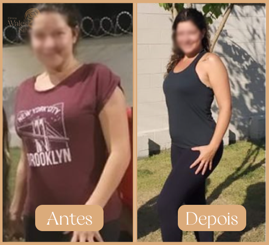 Antes-5-1
