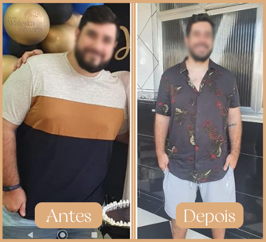 Antes-8-1