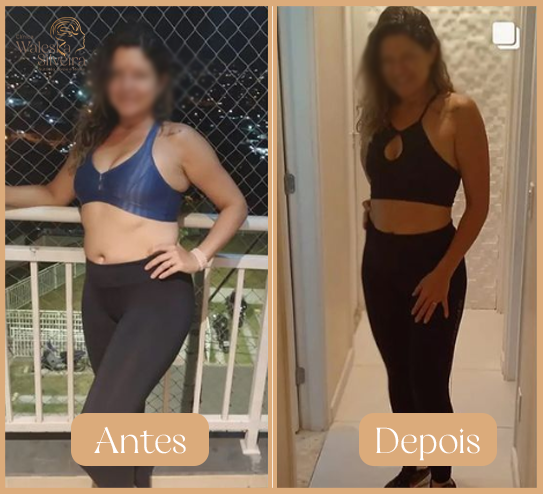 Antes-9-1