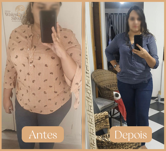 Depois-1